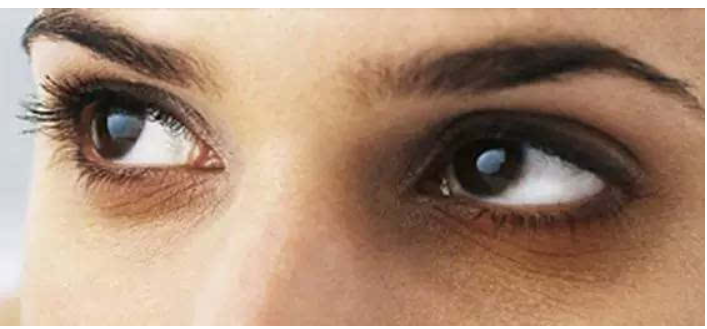 去黑眼圈的眼霜哪款好(黑眼圈用什么眼霜最好)(8)